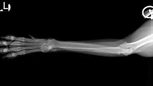 Learn about cat x ray costs and important facts about them. What Is The Average Cost Of X Rays For A Dog Quora