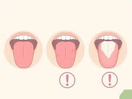 How to clean tongue naturally. How To Clean Your Tongue Properly 11 Steps With Pictures
