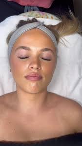 Transformation Wednesday: Hydrafacial addition✨, -, -, -, #beforeandafter  #lookatthatglow #A²medspa