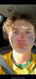 Aiden Long's Instagram, Twitter & Facebook