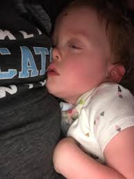 Pitbull owner hospitalized with severe dehydration