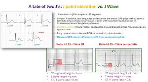 Image result for J Wave