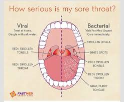 What Does Your Sore Throat Mean Health Resources Sick Remedies Good To Know