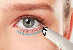 17 Bienfaits Incroyables De L Huile De Ricin Pour La Peau Les Cheveux Et La Sante Yeux Faire Soi Meme Argile Verte