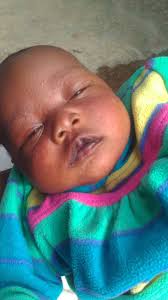 Any dry skin remedies for a 1-month-old?