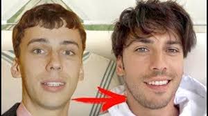 Его брат всегда был рядом. Kak Menyalsya Maksim Galkin S Detstva Do 2017 Youtube
