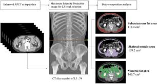 Development Of A Fully Automatic Deep Learning System For L3 Selection And Body Composition Assessment On Computed Tomography Scientific Reports