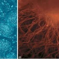 Metode dasar pengobatan stem cell. Pdf Stem Cell Past Present And Future A Review Article