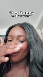 I Haven't Seen My Foot in 2 Years