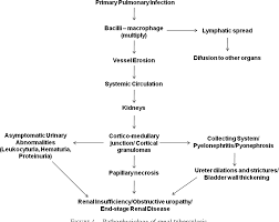 Image result for Genitourinary Tuberculosis