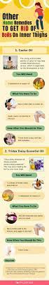 12 Home Remedies To Get Rid Of Boils On The Inner Thighs