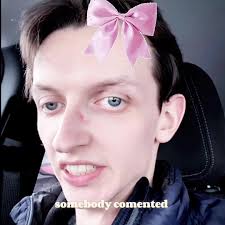 Guy Who Look Like Pigeon