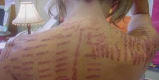 These side effects are expected due to the unusually intense application of light to the skin. Be Hairless Siowfa14 Science In Our World Certainty And Cont