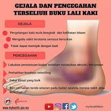 Dominan menggunakan tangan kiri dlm aktiviti harian. Terseliuh Buku Lali Kementerian Kesihatan Malaysia Facebook