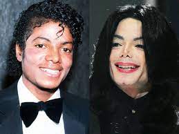12.11.2017 · they obsessive efforts result plastic surgery gone wrong. Celebrity Plastic Surgery Disasters Cbs News