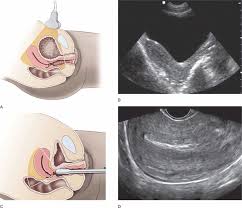 Gynecologic Concepts Radiology Key