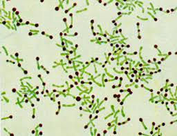 A minute amount of diphtheria toxin is injected into the skin of the forearm. Diphtheria Corynebacterium Diphtheriae History Symptoms Causes Treatment Schoolworkhelper