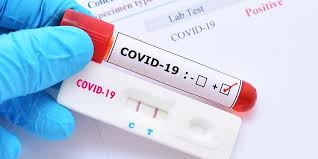 Rapid Test Corona Fungsi Prosedur Hasil Dan Efek Samping
