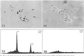 Figure 27 From Polyphosphate Granules Are An Artefact Of Specimen Preparation In The Ectomycorrhizal Funguspisolithus Tinctorius Semantic Scholar