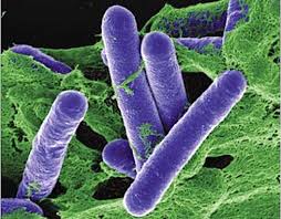 Foodborne botulism comes from eating foods contaminated with the toxin. Botulism Food Poisoning About Botulism