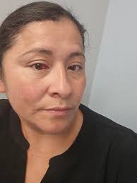 What causes a red spot