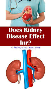Renal Failure Shopping Kidney Disease Chronic Kidney Disease Kidney Disease Stages