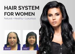 Superior Hair Replacement Non Surgical Hair Replacement Systems Hair Loss Solutions