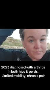 Lifewave X39 Patch Reviews for Pain Elbow