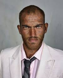 Pieter Hugo