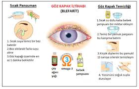 Blefarit Goz Kapagi Iltihabi Prof Dr Gokhan Gulkilik