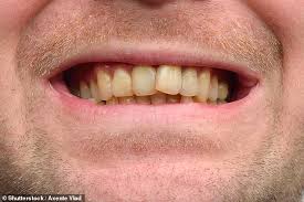We will develop this series as the situation progresses. Research Reveals Americans Think British People Have Bad Teeth And Australians Think We Re Ugly Daily Mail Online
