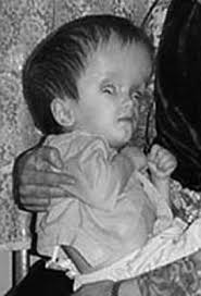 Chernobyl children international restores hope, alleviates suffering and protects current and future. 11 Research Ideas Chernobyl Chernobyl Disaster Nuclear Disasters