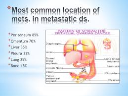 About 90% of women diagnosed what is the average age of uterine cancer? Ovarian Endometrial Cancer
