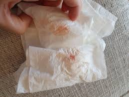 During the first 9 weeks of pregnancy, there can be poor spotty discharge, which can appear when a woman used to have periods. Chemical Pregnancy Or Implantation Bleeding Photo Included Trying To Conceive Forums What To Expect