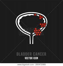 Just an fyi, according to the american cancer society, bladder cancer colors are marigold/blue/purple. Bladder Cancer Vector Photo Free Trial Bigstock