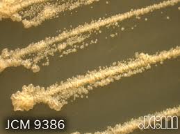 Image result for Putterlickia verrucosa