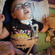 Insulated Ventilator CPAP Bipap Circuit Cover/wrap Prevents Condensation in  Circuit Tubing rainout