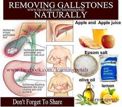 Removing Gallstones Naturally Even If You Don T Have Any Symptoms Of Gallstones You Still Might Have Some It S Always Good T Gallbladder Health Gallstones