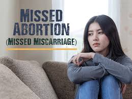 Check spelling or type a new query. Missed Abortion Missed Miscarriage Causes Symptoms Complications And Treatments Boldsky Com