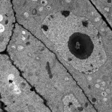 Transmission electron microscope images of cells. Transmission Electron Microscopy Theory Applications Study Com