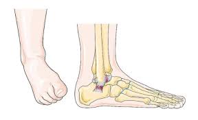 Ankle Mobility Exercises To Improve Dorsiflexion In 2020 Ankle Mobility Ankle Mobility Exercises Mobility Exercises