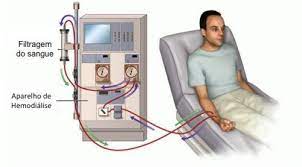 Saiba O Que E Hemodialise Tratamento Para Insuficiencia Renal Yes Saude Dialysis Kidney Disease Symptoms Kidney Disease