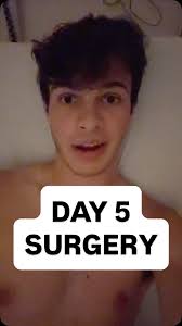 FEMUR UPDATE 🗣️🔊 I still have a lot of fatigue but again that's getting  better every day!!