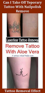 Click to learn more about how long it takes to remove tattoos. Tattoos Removal How To Remove Industrial Tattoo Shop Earrings How Is Tattoo Removal Done Did Sal Get His Tattoo Removal Cost Laser Tattoo Laser Tattoo Removal