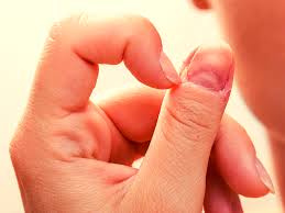 This can lead to symptoms such as headaches, trouble concentrating, weakness, seizures, vomiting, problems with balance, and blurred vision. If You Have This Mark On Your Nail Get Tested For Skin Cancer Times Of India