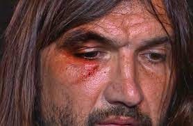 Cu toate că a negat vehement, declarând la vremea respectivă: 10 Lucruri Despre BÄƒtaia AdministratÄƒ De Anamaria Prodan Lui Dan Alexa