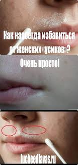как убрать усики в домашних условиях раз и навсегда Kak Navsegda Izbavitsya Ot Zhenskih Usikov Ochen Prosto Skin Care Skin Health Fitness