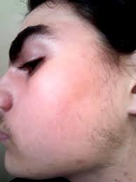 How to grow a beard: When Did You Start Growing Decent Facial Hair I Ve Always Wanted To Grow A Beard I M 18 And I Pretty Much Can T Grow Any Facial Hair I M Not Shaving The Crappy