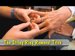 When My Friend Got Pregnant Her Fingers Swelled So Bad That Her Wedding Ring Became Uncomfortable She Tried Everythin How To Remove Emergency Room Ring Trick