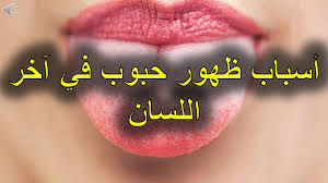 Start date nov 24, 2011. Ø£Ø³Ø¨Ø§Ø¨ Ø¸Ù‡ÙˆØ± Ø­Ø¨ÙˆØ¨ ÙÙŠ Ø¢Ø®Ø± Ø§Ù„Ù„Ø³Ø§Ù† Youtube